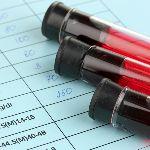 害怕感染 HIV，口交会比较安全吗？