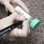 很遗憾，想通过普通体检「预测」癌症，目前还不大靠谱